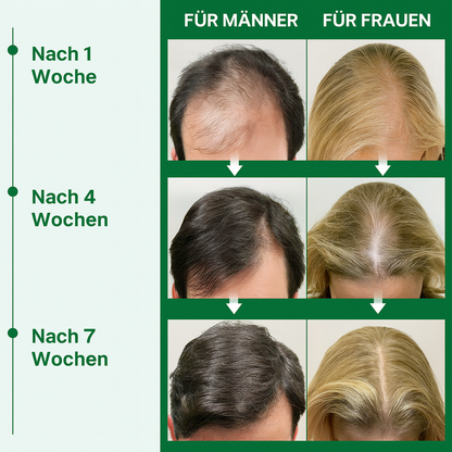 PURC Rosmarinöl – Haarwachstums- &amp; Kopfhautpflege